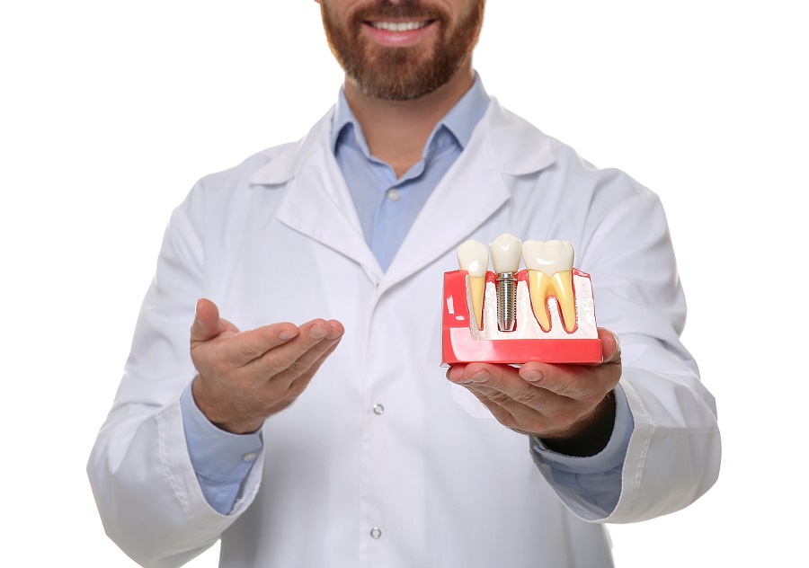 Why Dental Implants Are The Best Choice for Replacing Missing Teeth