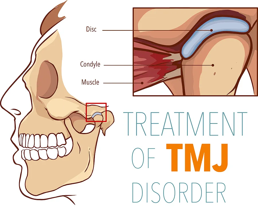 Relieve Jaw Pain with Comprehensive TMJ Treatment